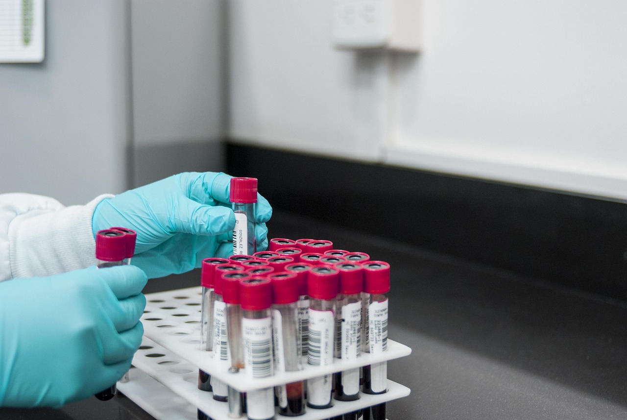 The Definitive 2025 Guide to HDL and LDL Cholesterol: Understanding Your Lipid Panel and Ratio