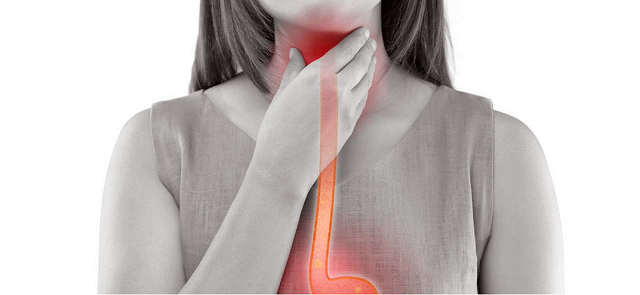 The Definitive Guide to Foods That Cause Gas, Bloating, and Digestive Discomfort